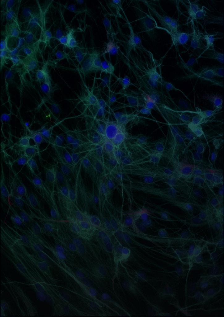 Listing cover image