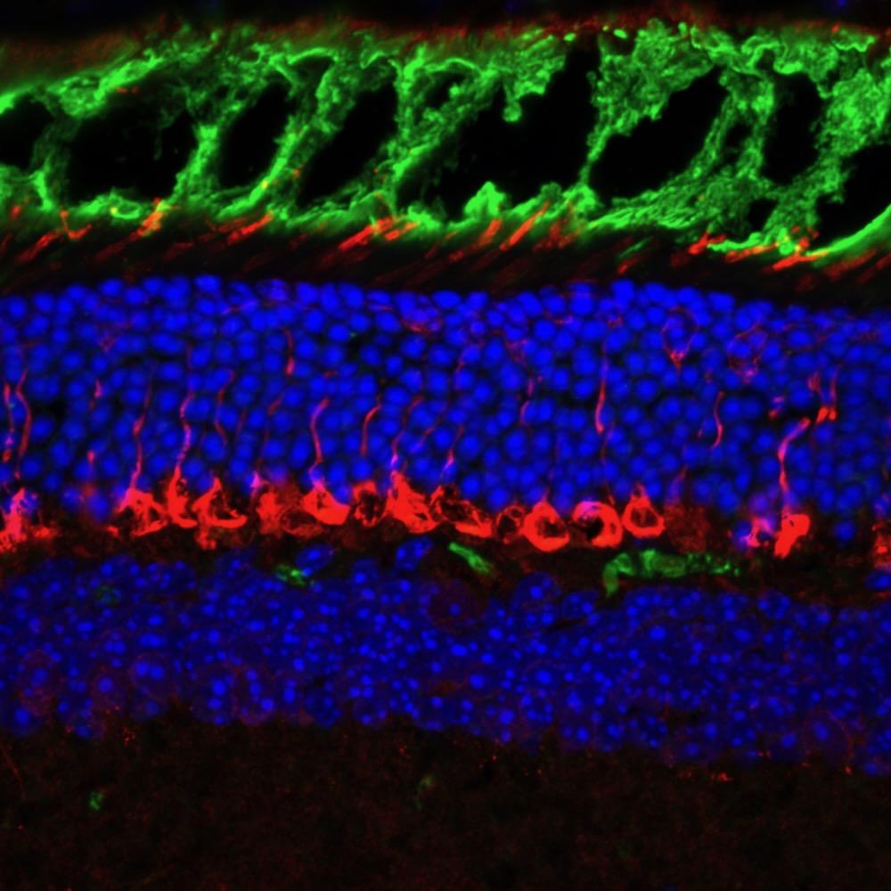 Listing cover image